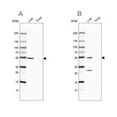 Anti-HGD antibody produced in rabbit Prestige Antibodies® Powered by Atlas Antibodies, affinity isolated antibody, buffered aqueous glycerol solution