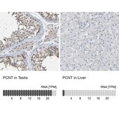 Anti-PCNT antibody produced in rabbit Prestige Antibodies® Powered by Atlas Antibodies, affinity isolated antibody, buffered aqueous glycerol solution, Ab2