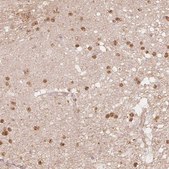Anti-QDPR antibody produced in rabbit Prestige Antibodies® Powered by Atlas Antibodies, affinity isolated antibody, buffered aqueous glycerol solution