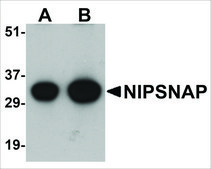 Anti-NIPSNAP (ab1) antibody produced in rabbit affinity isolated antibody, buffered aqueous solution