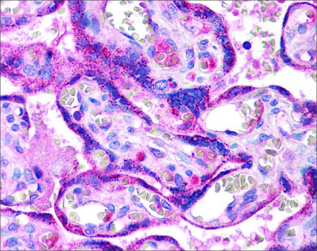 Anti-RYBP antibody produced in rabbit affinity isolated antibody