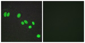 Anti-NCOR2 antibody produced in rabbit affinity isolated antibody