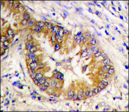 Anti-POTE (C-term) antibody produced in rabbit affinity isolated antibody, buffered aqueous solution