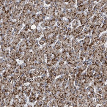 Anti-ACBD4 antibody produced in rabbit Prestige Antibodies&#174; Powered by Atlas Antibodies, affinity isolated antibody, buffered aqueous glycerol solution