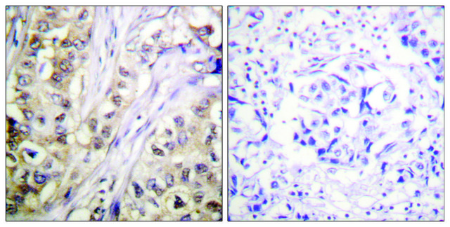 Anti-Survivin antibody produced in rabbit affinity isolated antibody