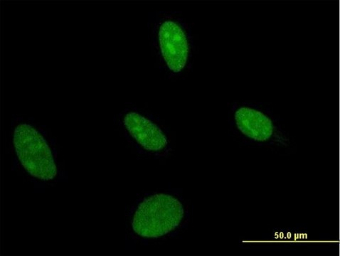 Monoclonal Anti-UMPS antibody produced in mouse clone 2F5, purified immunoglobulin, buffered aqueous solution