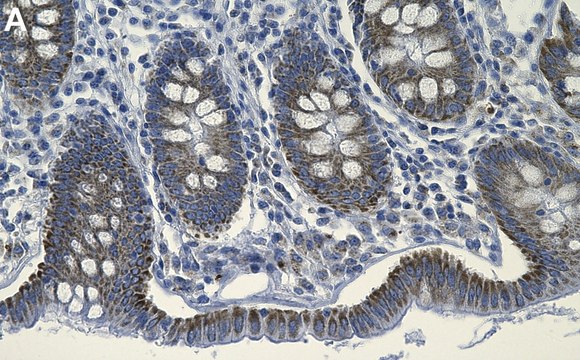 Anti-PBR/TSPO Antibody, clone 1E8 ZooMAb&#174; Rabbit Monoclonal recombinant, expressed in HEK 293 cells