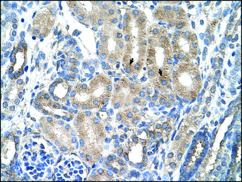 Anti-AGER (AB2) antibody produced in rabbit IgG fraction of antiserum