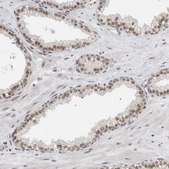Anti-NCAPG2 antibody produced in rabbit Prestige Antibodies® Powered by Atlas Antibodies, affinity isolated antibody, buffered aqueous glycerol solution