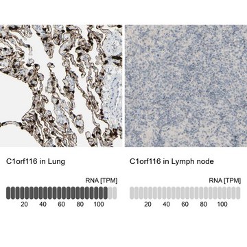 Anti-C1orf116 antibody produced in rabbit Prestige Antibodies&#174; Powered by Atlas Antibodies, affinity isolated antibody, buffered aqueous glycerol solution