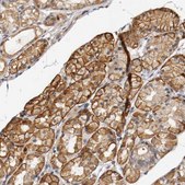 Anti-TNFRSF1B antibody produced in rabbit Prestige Antibodies® Powered by Atlas Antibodies, affinity isolated antibody, buffered aqueous glycerol solution
