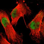 Anti-ACIN1 antibody produced in rabbit Prestige Antibodies® Powered by Atlas Antibodies, affinity isolated antibody, buffered aqueous glycerol solution