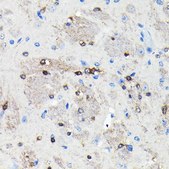 Anti-NMDAR2A antibody produced in rabbit