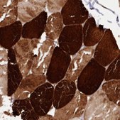 Anti-ANKRD2 antibody produced in rabbit Prestige Antibodies® Powered by Atlas Antibodies, affinity isolated antibody, buffered aqueous glycerol solution