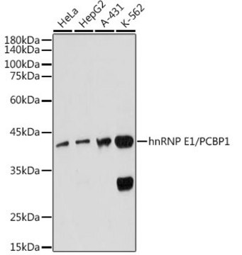 Anti-hnRNP E1/PCBP1 Antibody, clone 7M1K0, Rabbit Monoclonal