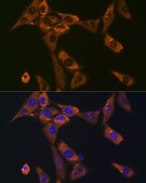 Anti-Galectin 1/LGALS1 antibody produced in rabbit