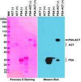 Anti-PSA (Prostate Specific Antigen) antibody, Rabbit monoclonal recombinant, expressed in HEK 293 cells, clone RM323, purified immunoglobulin