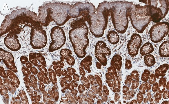 Anti-NQO1 Antibody, clone 1D12 ZooMAb&#174; Rabbit Monoclonal recombinant, expressed in HEK 293 cells