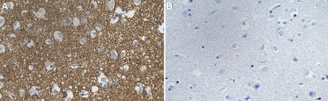 Anti-BASP1/NAP-22 Antibody, clone 2C11 ZooMAb&#174; Rabbit Monoclonal recombinant, expressed in HEK 293 cells