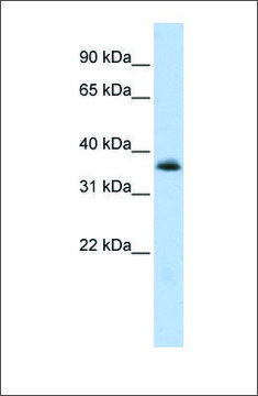 Anti-MNX1 affinity isolated antibody