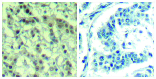 Anti-phospho-AURKA (pThr288) antibody produced in rabbit affinity isolated antibody