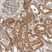 Anti-RABIF antibody produced in rabbit Prestige Antibodies® Powered by Atlas Antibodies, affinity isolated antibody, buffered aqueous glycerol solution