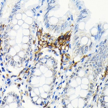 Anti-HLA-DRB1 antibody produced in rabbit