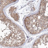 Anti-SEC23IP antibody produced in rabbit Prestige Antibodies® Powered by Atlas Antibodies, affinity isolated antibody, buffered aqueous glycerol solution