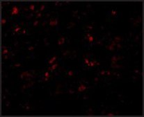 Anti-AP2M1 antibody produced in chicken affinity isolated antibody, buffered aqueous solution
