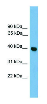 Anti-GNAI3 antibody produced in rabbit affinity isolated antibody