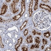 Anti-PRSS35 antibody produced in rabbit Prestige Antibodies® Powered by Atlas Antibodies, affinity isolated antibody, buffered aqueous glycerol solution