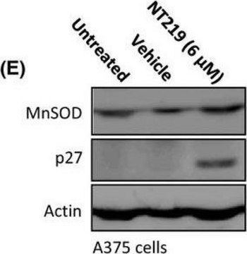 Anti-Mn-SOD Antibody Upstate&#174;, from rabbit