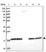 Anti-NDUFB6 antibody produced in rabbit Prestige Antibodies® Powered by Atlas Antibodies, affinity isolated antibody, buffered aqueous glycerol solution