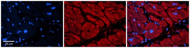 Anti-TRIM39 antibody produced in rabbit affinity isolated antibody