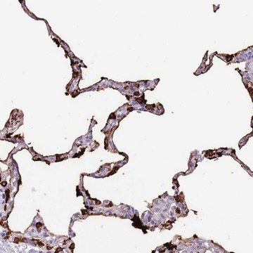 Anti-SFTPA1 antibody produced in rabbit Prestige Antibodies&#174; Powered by Atlas Antibodies, affinity isolated antibody, buffered aqueous glycerol solution