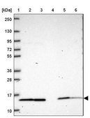 Anti-NDUFS6 antibody produced in rabbit Prestige Antibodies® Powered by Atlas Antibodies, affinity isolated antibody, buffered aqueous glycerol solution