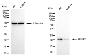 KD-Validated Anti UBE2T Antibody, clone 24GB2350, Rabbit Monoclonal clone 24GB2350, recombinant rabbit monoclonal, expressed in HEK293 cells