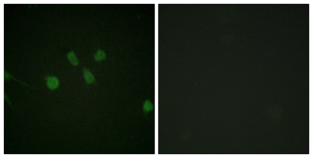 Anti-MAD1 antibody produced in rabbit affinity isolated antibody