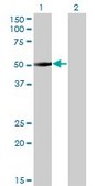 Monoclonal Anti-ZNF213 antibody produced in mouse clone 5D7, purified immunoglobulin, buffered aqueous solution