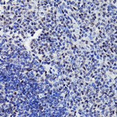 Anti-Phospho-STAT3-S727 antibody produced in rabbit