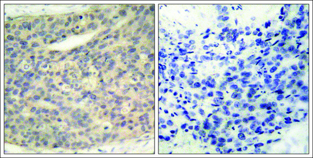 Anti-phospho-LIMK1 (pThr508) antibody produced in rabbit affinity isolated antibody