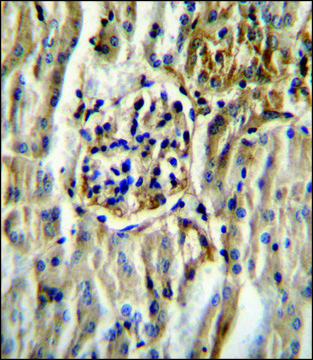 ANTI-CYP11B2 (CENTER) antibody produced in rabbit IgG fraction of antiserum, buffered aqueous solution