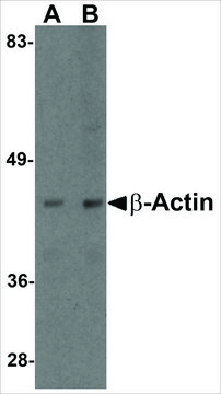 Anti-&#946;-Actin antibody produced in chicken affinity isolated antibody, buffered aqueous solution