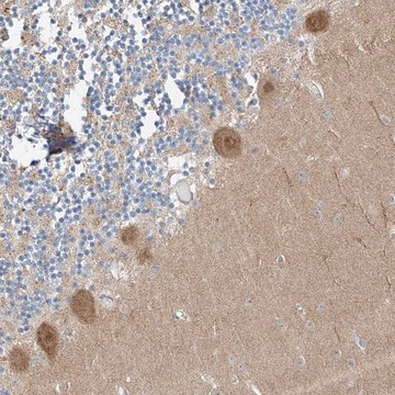 Anti-CLDND1 antibody produced in rabbit Prestige Antibodies&#174; Powered by Atlas Antibodies, affinity isolated antibody, buffered aqueous glycerol solution, ab1