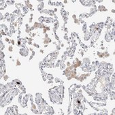 Anti-HPGDS antibody produced in rabbit Prestige Antibodies® Powered by Atlas Antibodies, affinity isolated antibody, buffered aqueous glycerol solution