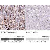Anti-GALNT7 antibody produced in rabbit Prestige Antibodies® Powered by Atlas Antibodies, affinity isolated antibody, buffered aqueous glycerol solution