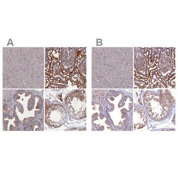 Anti-TMC5 antibody produced in rabbit Prestige Antibodies&#174; Powered by Atlas Antibodies, affinity isolated antibody, buffered aqueous glycerol solution