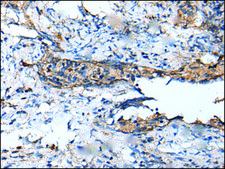 Anti-DEFB104A affinity isolated antibody