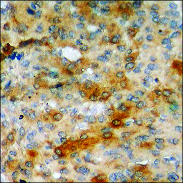 Anti-phospho-Adrenergic Receptor &#946;2 (pSer346) antibody produced in rabbit affinity isolated antibody