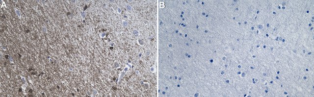 Anti-ASPA Antibody, clone 1F21 ZooMAb&#174; Rabbit Monoclonal recombinant, expressed in HEK 293 cells